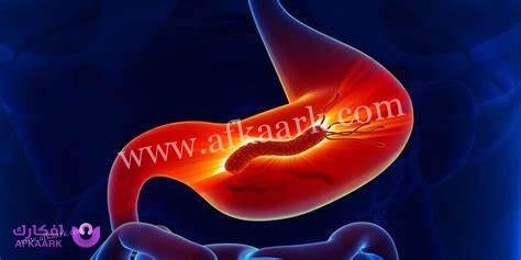فوائد السريس لجرثومة المعدة وطريقة الاستخدام 3 فوائد السريس لجرثومة المعدة